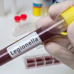 Hand of researcher holds test tube with blood for Legionella tes