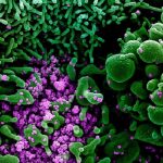 Virus