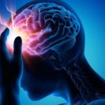 Covid cerebro-1